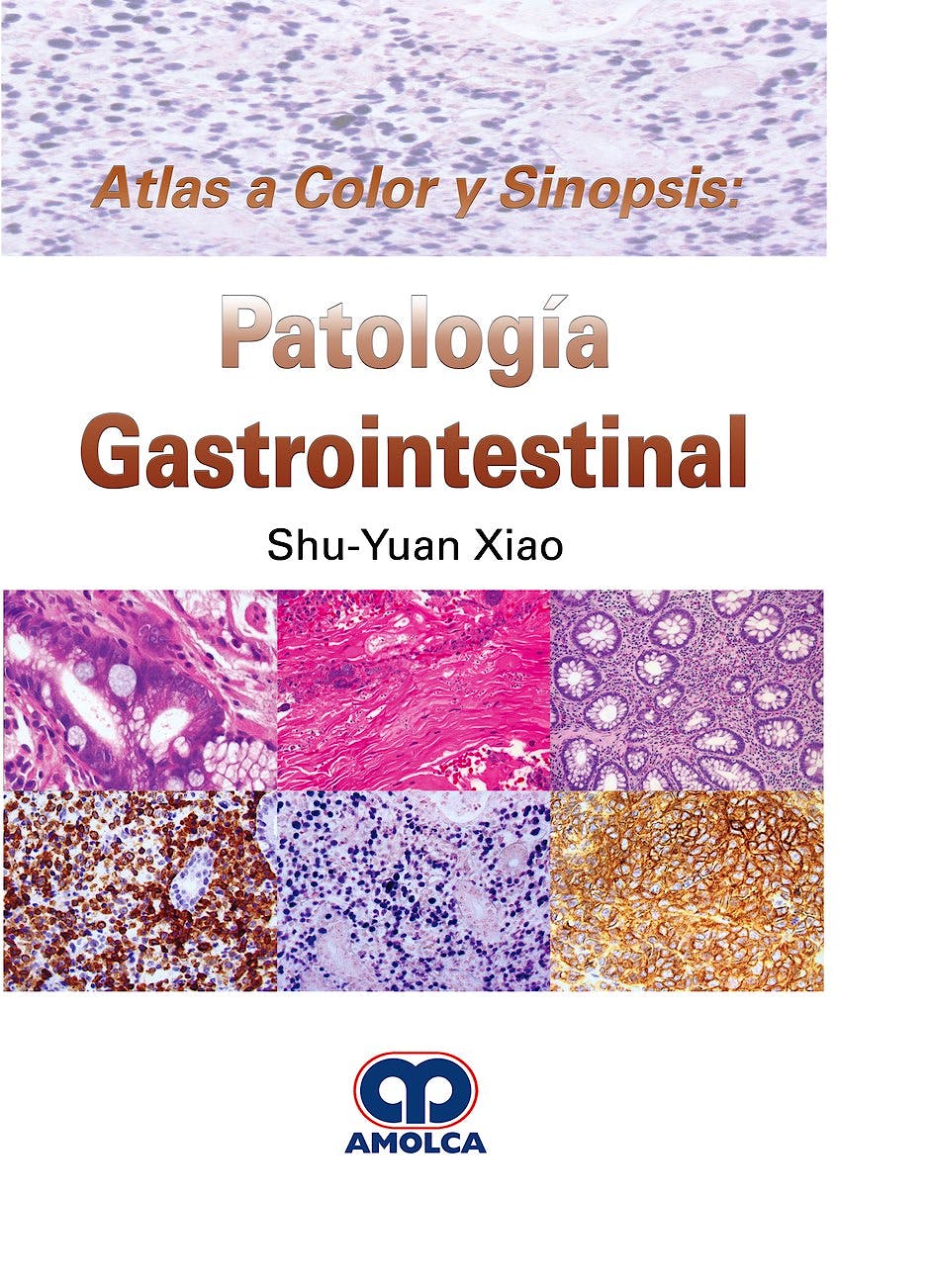 Portada del libro 9789585426177 Atlas a Color y Sinopsis: Patología Gastrointestinal