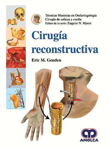 Portada del libro 9789585426238 Cirugía Reconstructiva (Técnicas Maestras en ORL)