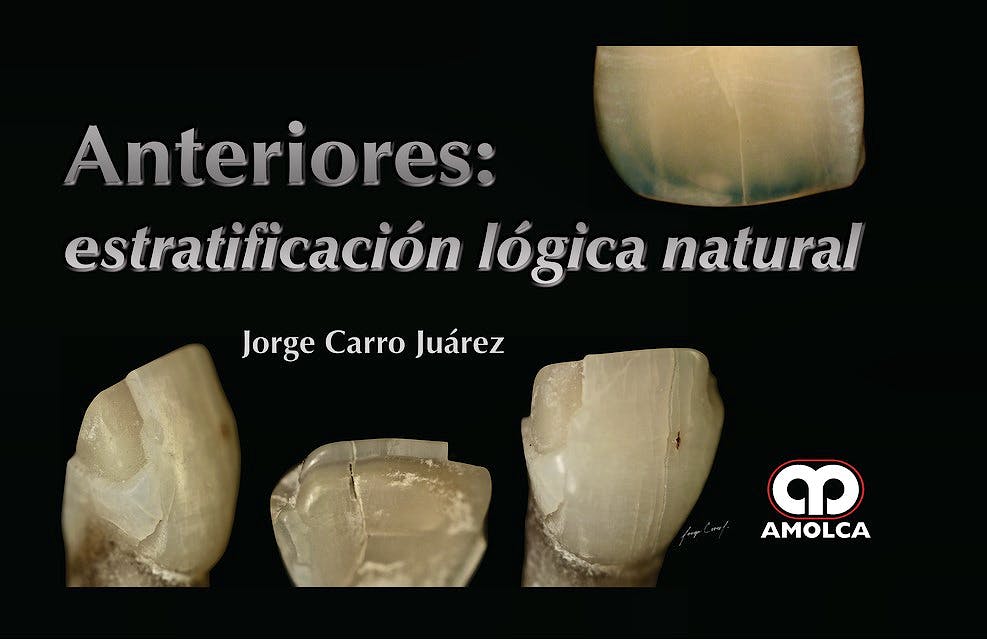 Portada del libro 9789585426313 Anteriores: Estratificación Lógica Natural
