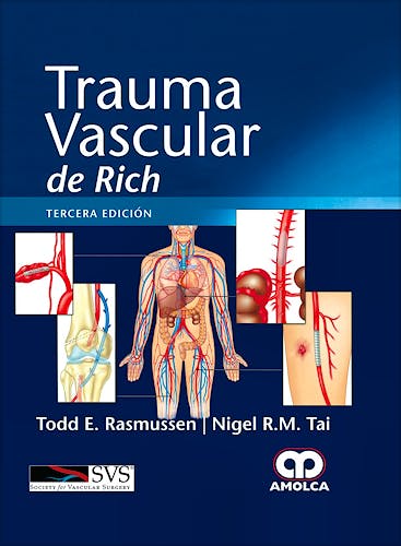 Portada del libro 9789585426320 Trauma Vascular de Rich