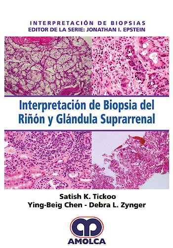 Portada del libro 9789585426610 Interpretación de Biopsia del Riñón y Glándula Suprarrenal (Interpretación de Biopsias)
