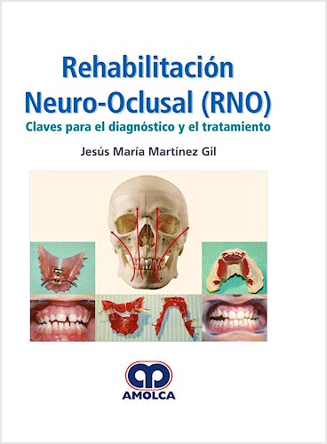 Portada del libro 9789585426641 Rehabilitación Neuro-Oclusal (RNO). Claves para el Diagnóstico y el Tratamiento