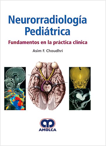 Portada del libro 9789585426672 Neurorradiología Pediátrica. Fundamentos en la Práctica Clínica
