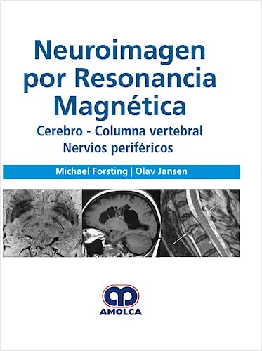 Portada del libro 9789585426726 Neuroimagen por Resonancia Magnética. Cerebro, Columna Vertebral, Nervios Periféricos