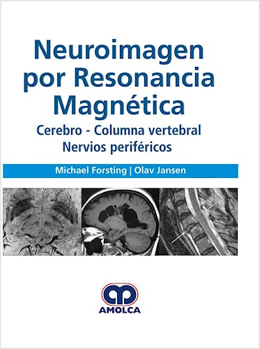 Portada del libro 9789585426726 Neuroimagen por Resonancia Magnética. Cerebro, Columna Vertebral, Nervios Periféricos