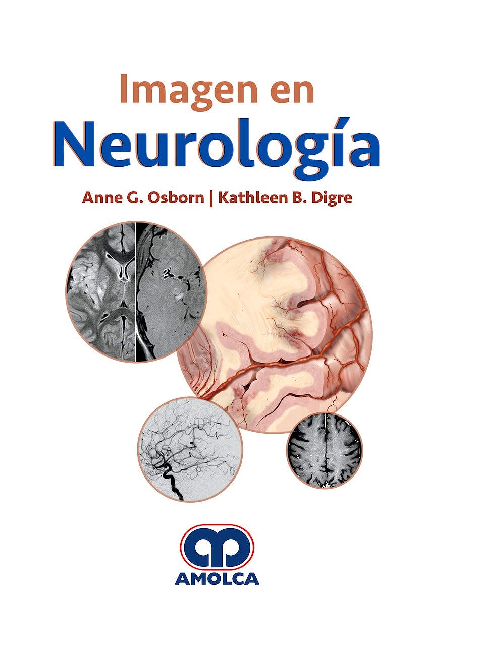 Portada del libro 9789585426788 Imagen en Neurología