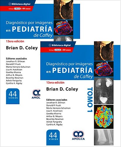 Portada del libro 9789585598478 CAFFEY Diagnóstico por Imágenes en Pediatría (2 Volúmenes + 44 Videos)