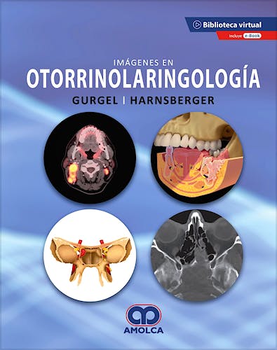 Portada del libro 9789585598492 Imágenes en Otorrinolaringología