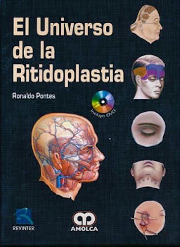 Portada del libro 9789585729131 El Universo de la Ritidoplastia