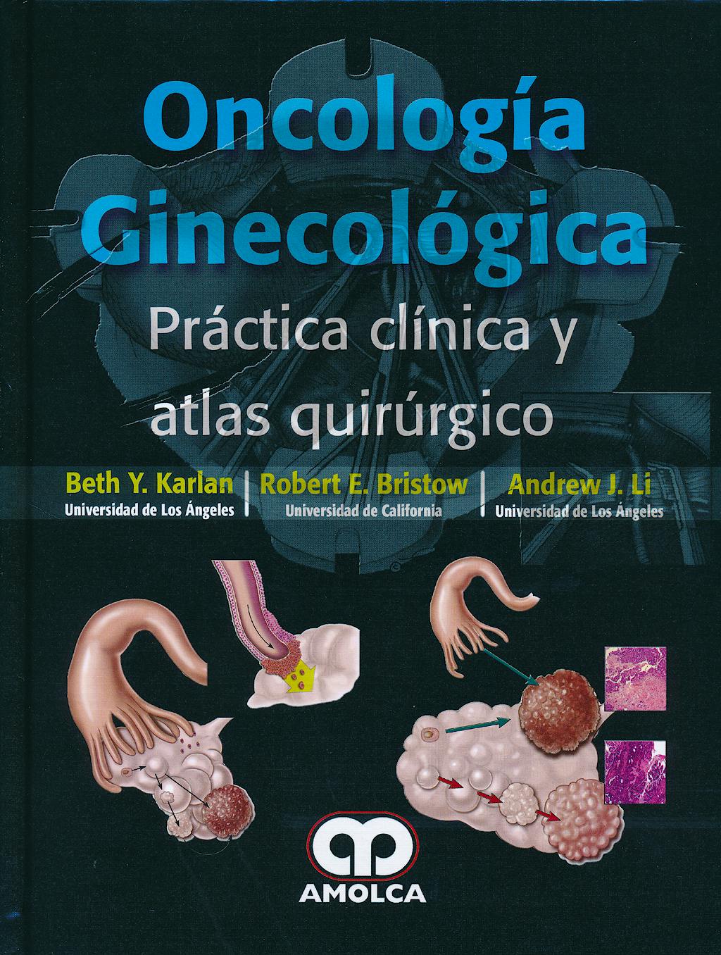 Portada del libro 9789585902053 Oncologia Ginecologica. Practica Clinica y Atlas Quirurgico