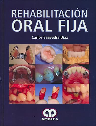 Portada del libro 9789585911314 Rehabilitación Oral Fija