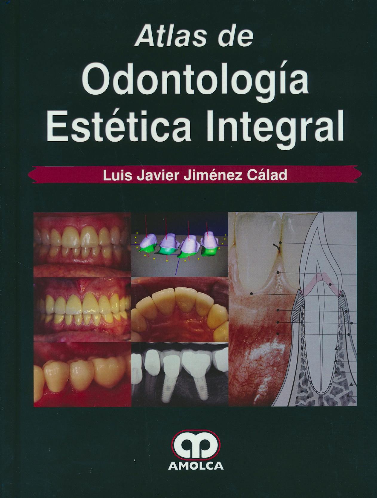 Portada del libro 9789585911321 Atlas de Odontología Estética Integral