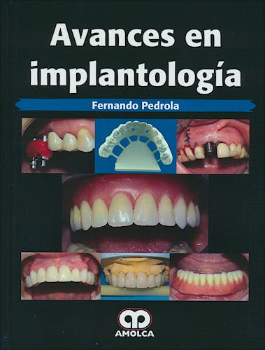 Portada del libro 9789585911338 Avances en Implantología