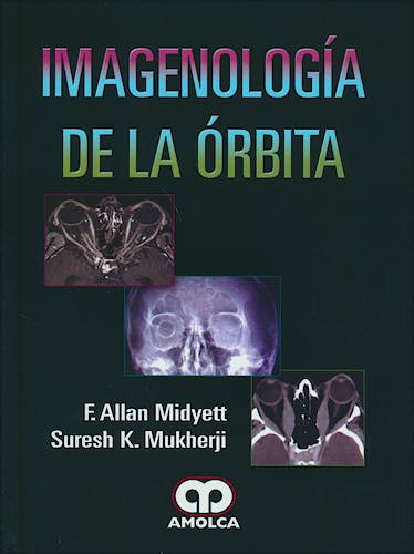 Portada del libro 9789585911345 Imagenología de la Órbita