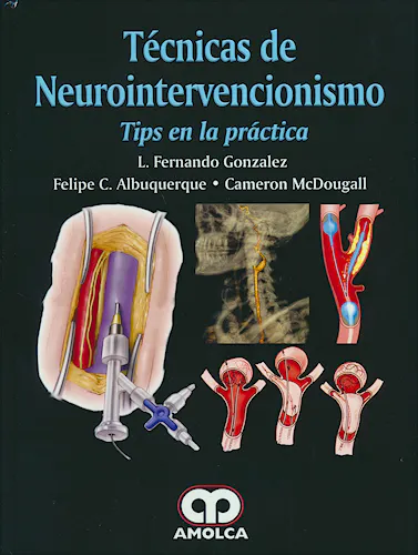 Portada del libro 9789585913714 Técnicas de Neurointervencionismo. Tips en la Práctica