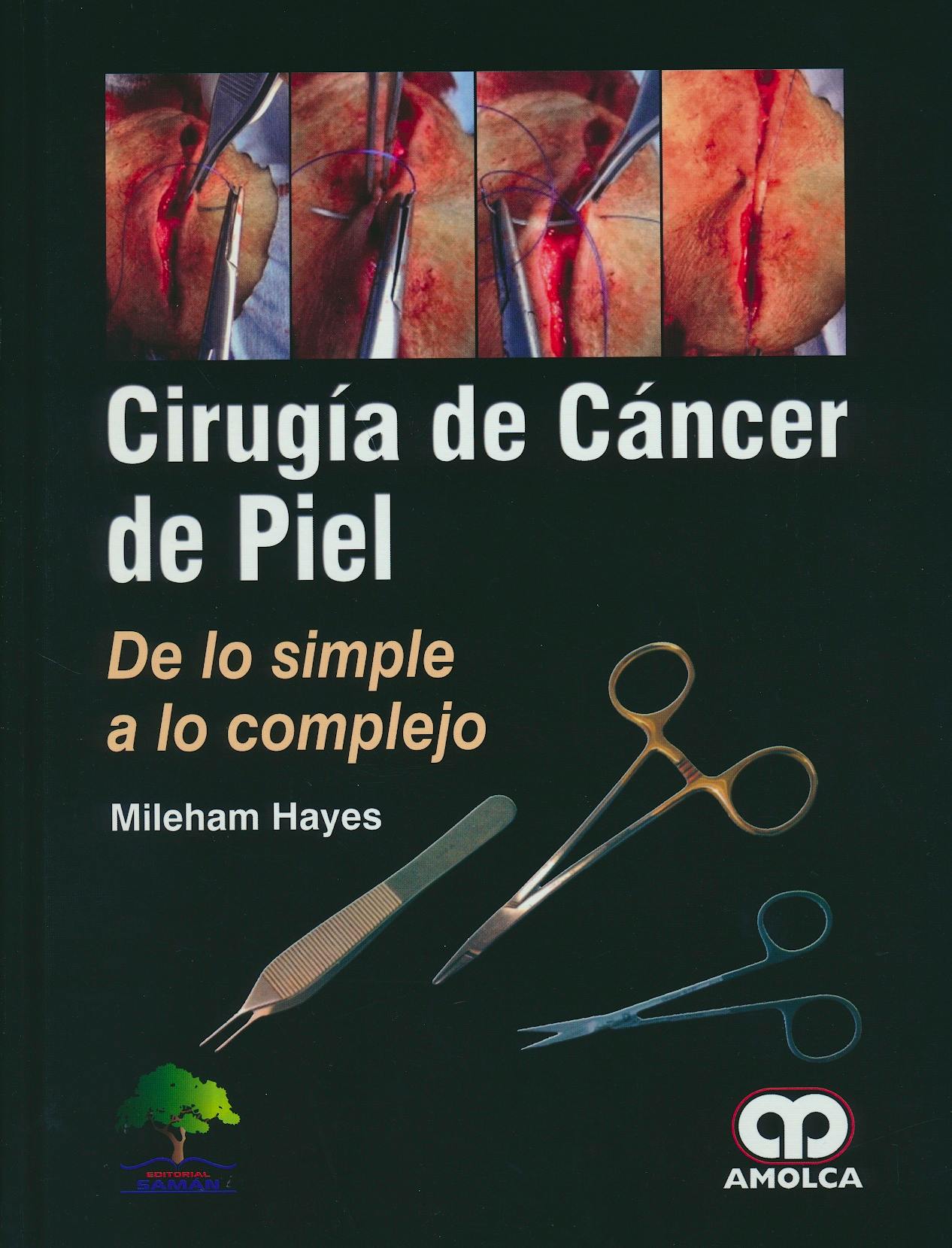 Portada del libro 9789585913721 Cirugía de Cáncer de Piel. De lo Simple a lo Complejo