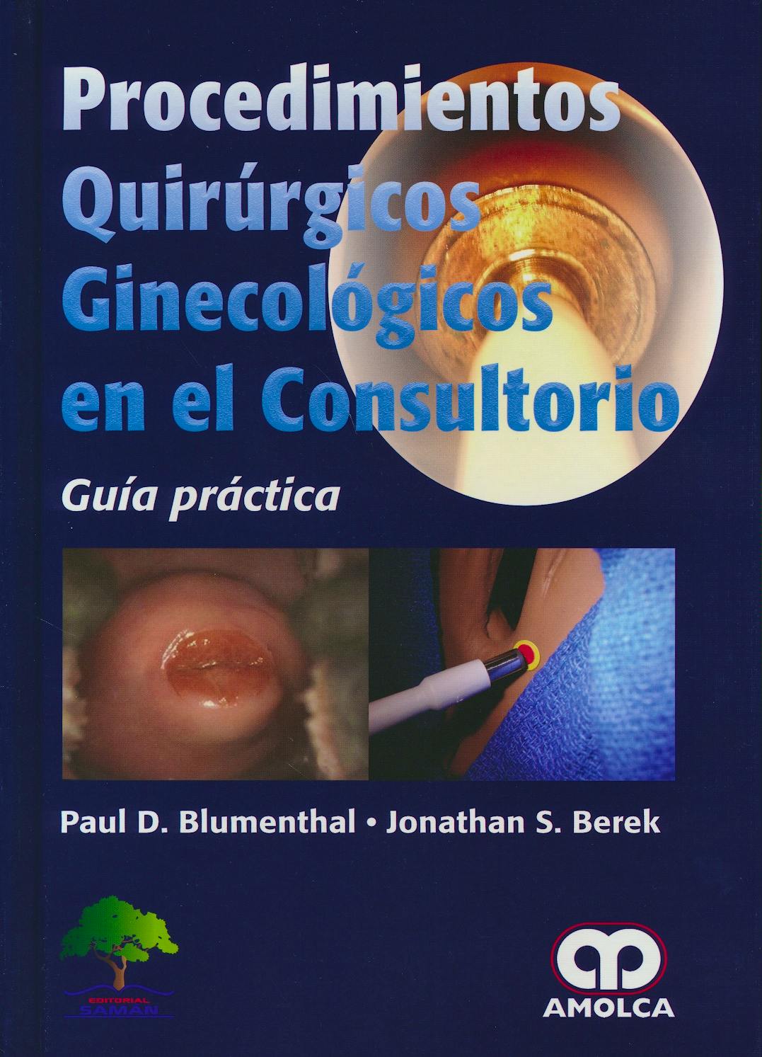 Portada del libro 9789585913738 Procedimientos Quirúrgicos Ginecológicos en el Consultorio. Guía Práctica