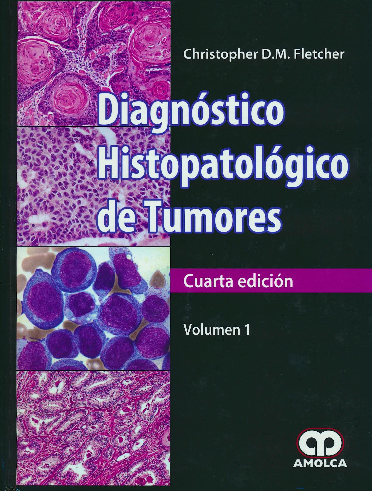 Portada del libro 9789585913752 Diagnóstico Histopatológico de Tumores, 2 Vols.