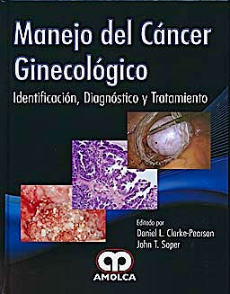 Portada del libro 9789587550207 Manejo del Cancer Ginecologico. Identificacion, Diagnostico y Tratamiento