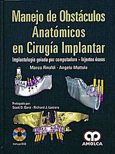 Portada del libro 9789587550238 Manejo de Obstáculos Anatómicos en Cirugía Implantar. Implantología Guiada por Computadora - Injertos Óseos