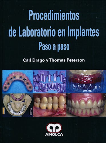 Portada del libro 9789587550290 Procedimientos de Laboratorio en Implantes. Paso a Paso
