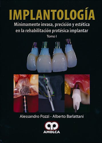 Portada del libro 9789587550337 Implantología Mínimamente Invasiva, Precisión y Estética en la Rehabilitación Protésica Implantar (2 vols.)