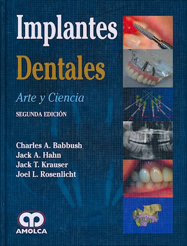 Portada del libro 9789587550368 Implantes Dentales. Arte y Ciencia