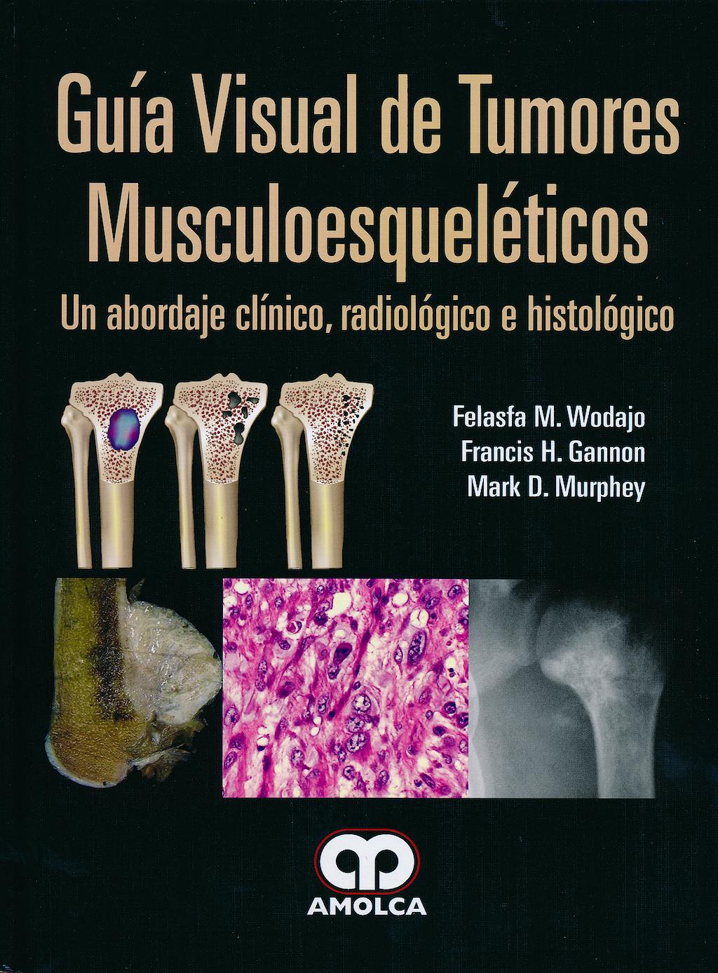 Portada del libro 9789587550450 Guía Visual de Tumores Musculoesqueléticos. Un Abordaje Clínico, Radiológico e Histológico