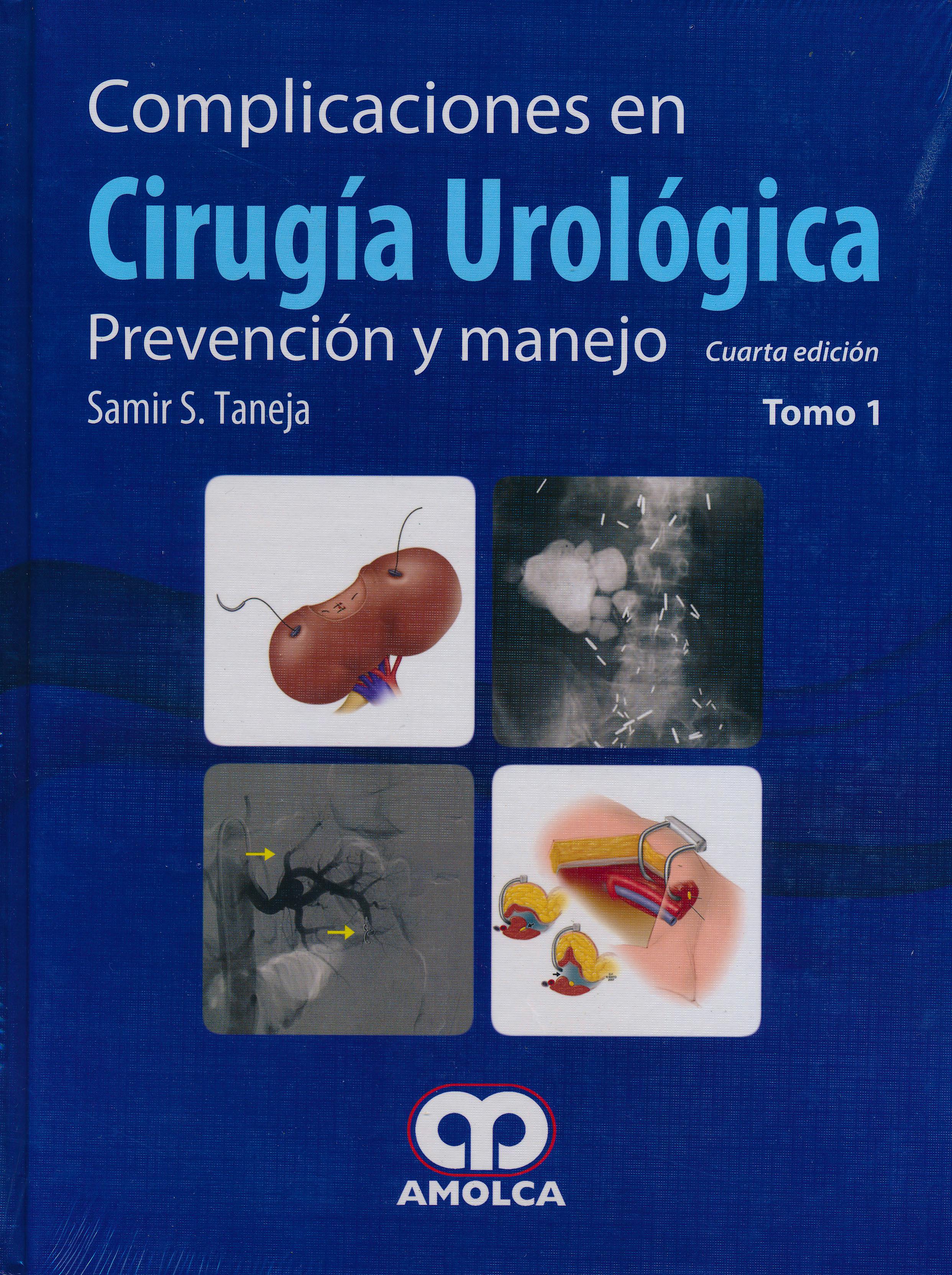 Portada del libro 9789587550542 Complicaciones en Cirugía Urológica. Prevención y Manejo, 2 Tomos