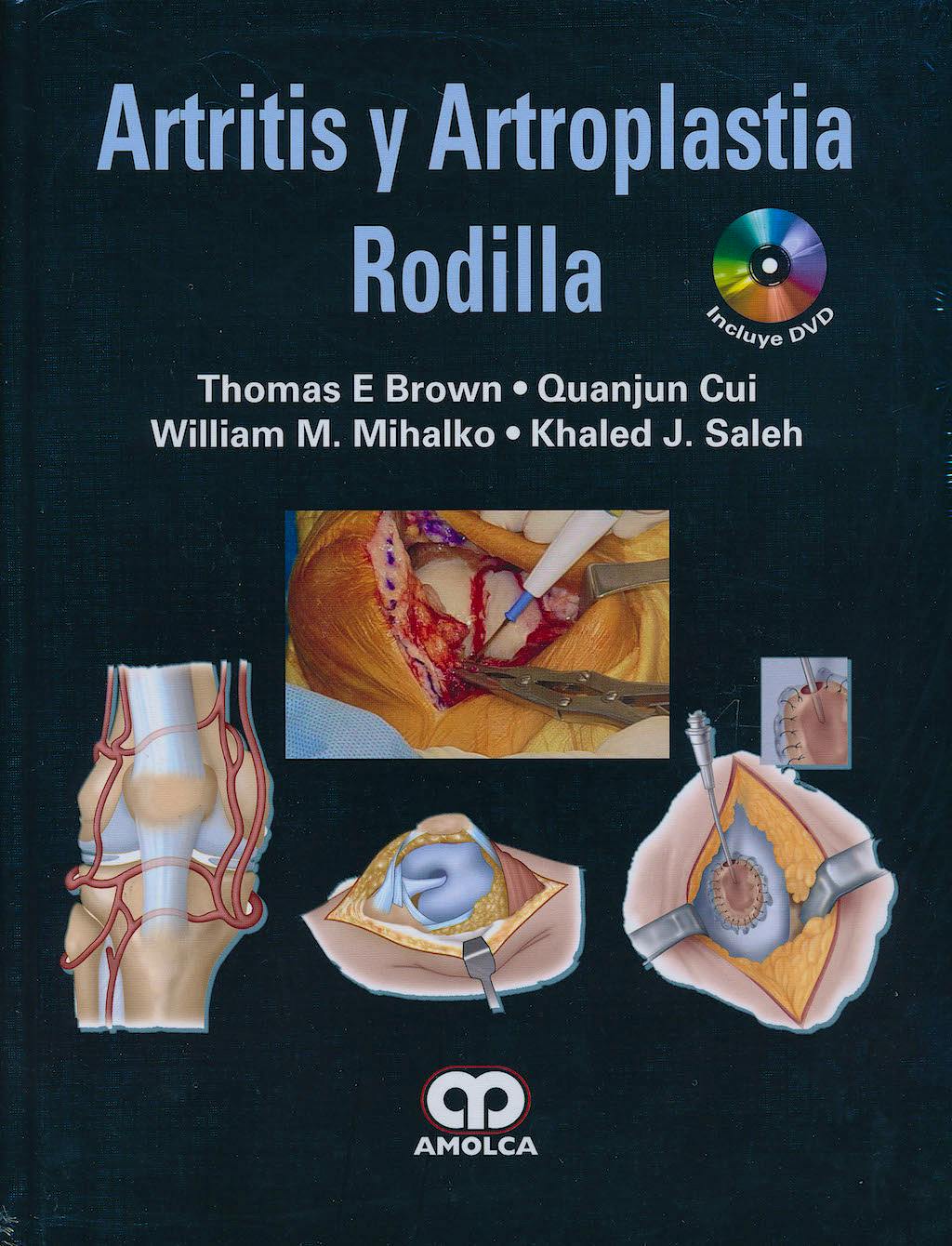 Portada del libro 9789587550559 Artritis y Artroplastia de Rodilla