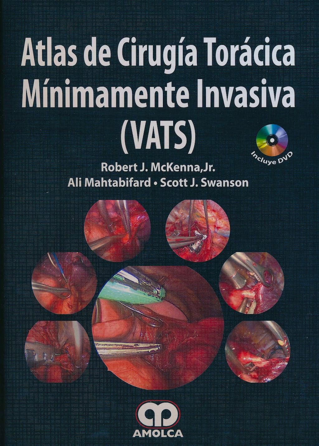 Portada del libro 9789587550757 Atlas de Cirugía Torácica Minimamente Invasiva (VATS)