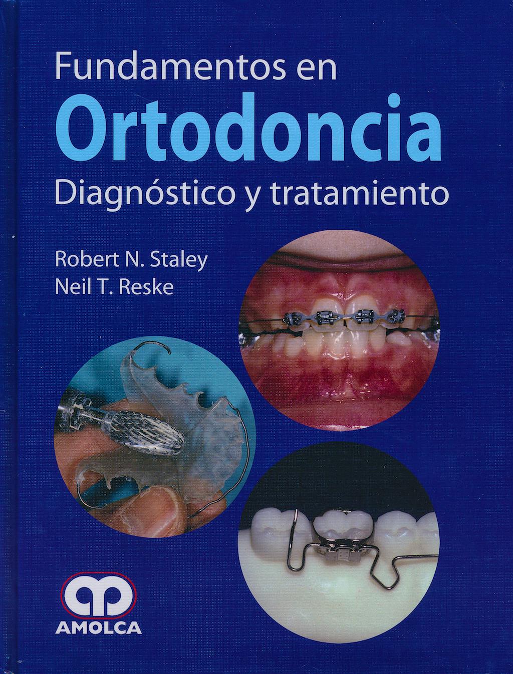 Fundamentos En Ortodoncia. Diagnóstico Y Tratamiento: 9789587550801 ...