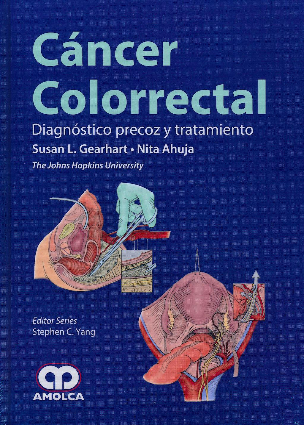 Portada del libro 9789587550825 Cancer Colorrectal. Diagnostico Precoz y Tratamiento