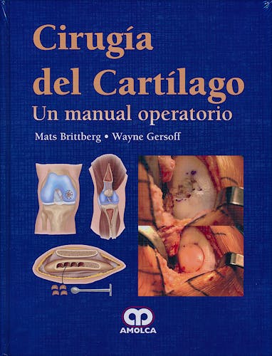 Portada del libro 9789587550832 Cirugía del Cartílago. Un Manual Operatorio