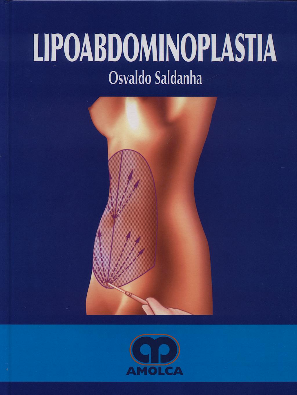 Portada del libro 9789588328058 Lipoabdominoplastia