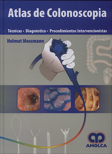 Portada del libro 9789588328089 Atlas de Colonoscopia. Técnicas - Diagnóstico - Procedimientos Intervencionistas
