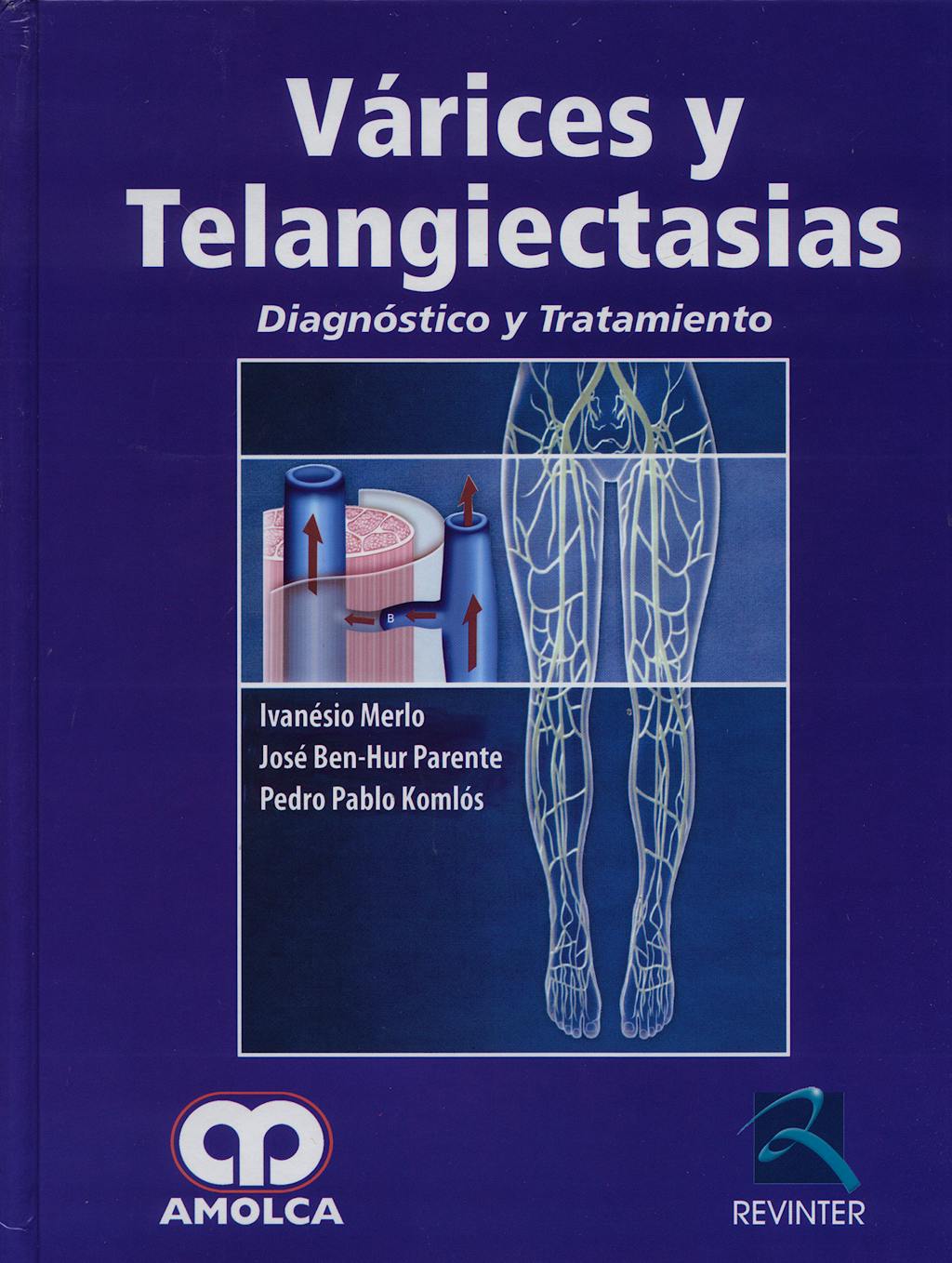 Portada del libro 9789588328126 Varices y Telangiectasias. Diagnóstico y Tratamiento
