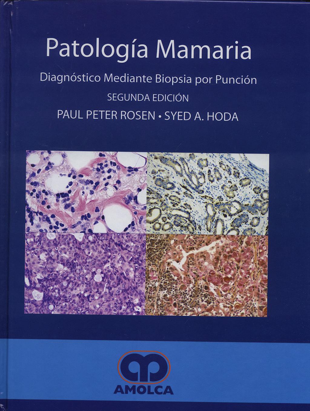 Portada del libro 9789588328133 Patología Mamaria. Diagnóstico mediante Biopsia por Punción