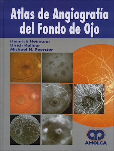 Portada del libro 9789588328287 Atlas de Angiografía del Fondo de Ojo