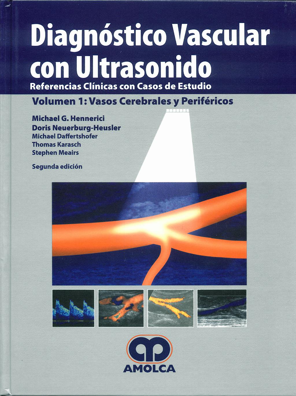 Portada del libro 9789588328362 Diagnóstico Vascular con Ultrasonido, Vol. 1: Vasos Cerebrales y Periféricos