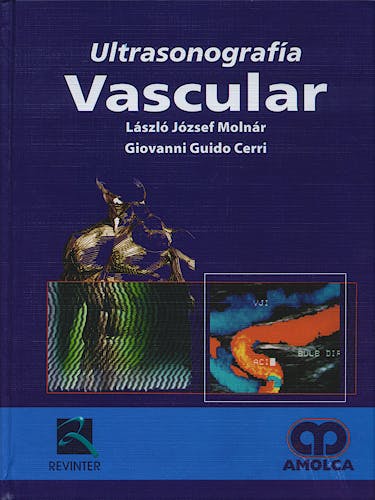 Portada del libro 9789588328447 Ultrasonografía Vascular