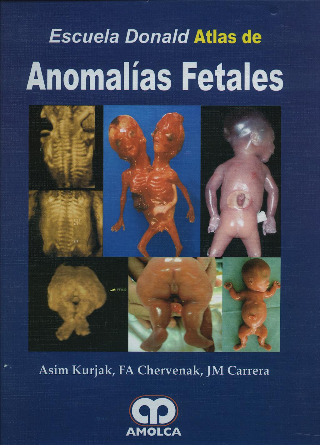 Portada del libro 9789588328546 Escuela Donald Atlas de Anomalías Fetales