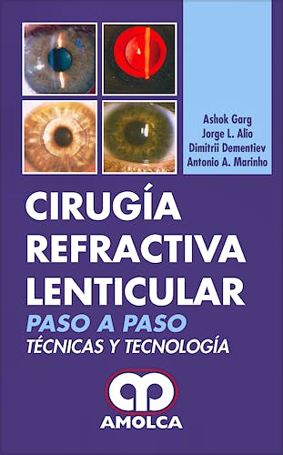 Portada del libro 9789588328713 Cirugía Refractiva Lenticular. Paso a Paso. Técnicas y Tecnología