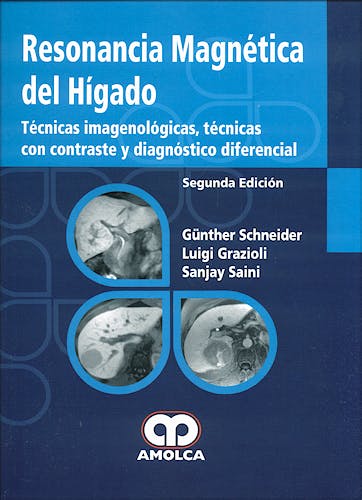 Portada del libro 9789588328799 Resonancia Magnética del Higado. Técnicas Imagenológicas, Técnicas con Contraste y Diagnóstico Diferencial