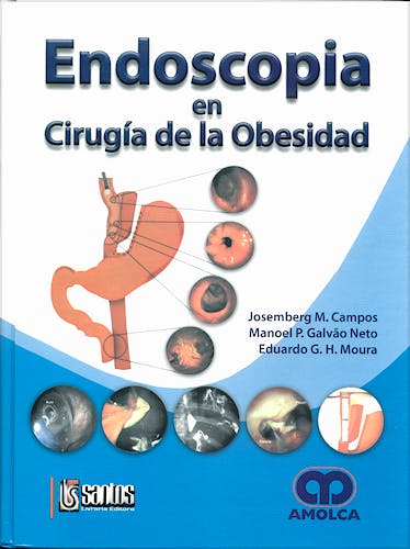 Portada del libro 9789588328980 Endoscopia en Cirugía de la Obesidad