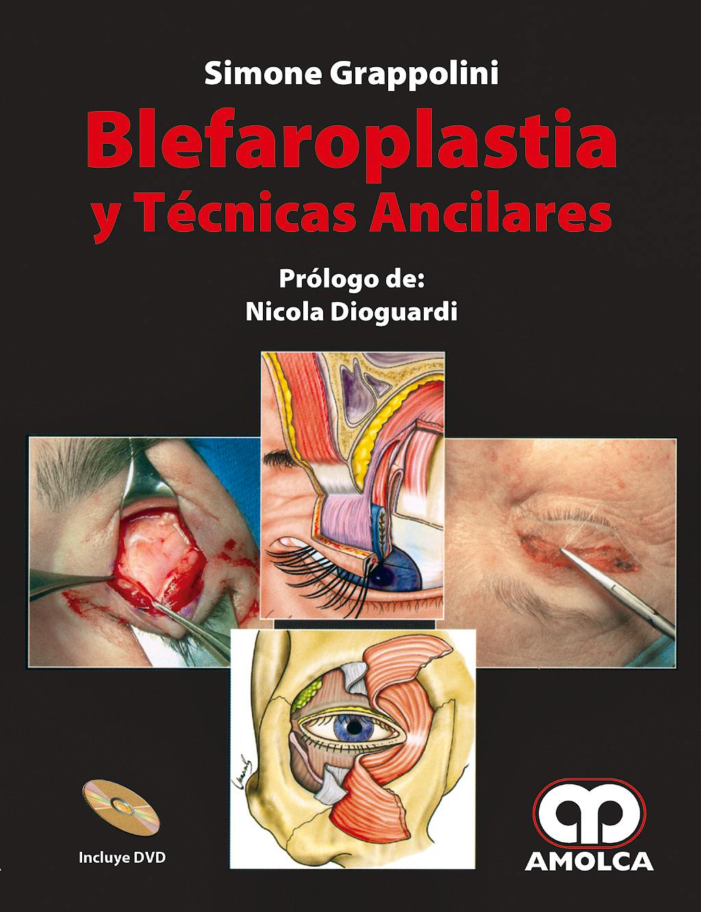 Portada del libro 9789588473086 Blefaroplastia y Técnicas Ancilares