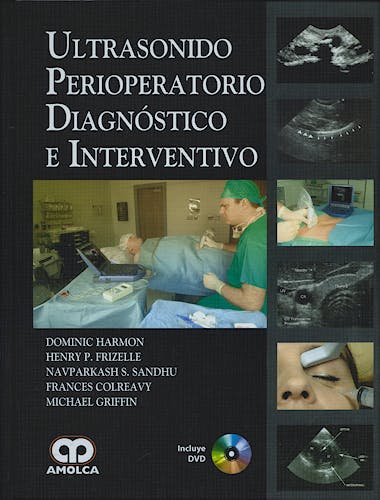 Portada del libro 9789588473109 Ultrasonido Perioperatorio Diagnóstico e Interventivo