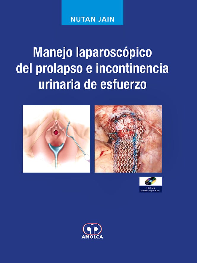 Portada del libro 9789588473123 Manejo Laparoscópico del Prolapso e Incontinencia Urinaria de Esfuerzo