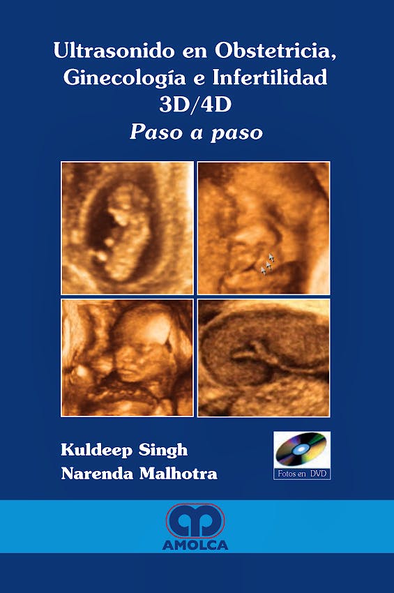 Portada del libro 9789588473130 Ultrasonido en Obstetricia, Ginecología e Infertilidad 3D/4D. Paso a Paso + CD