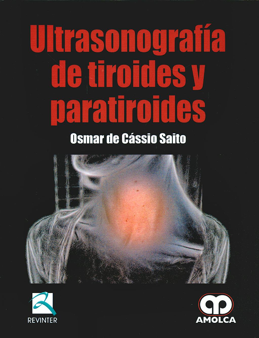 Portada del libro 9789588473154 Ultrasonografía de Tiroides y Paratiroides